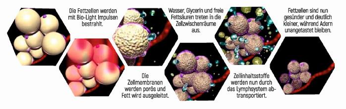 Bilder_Fettzelle_Biolicht-Lipolyse